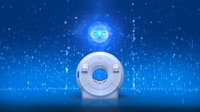 Sistema de ressonância magnética Philips com IA e visualização digital de inteligência artificial