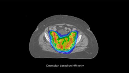 Automatic generation of synthetic CT images