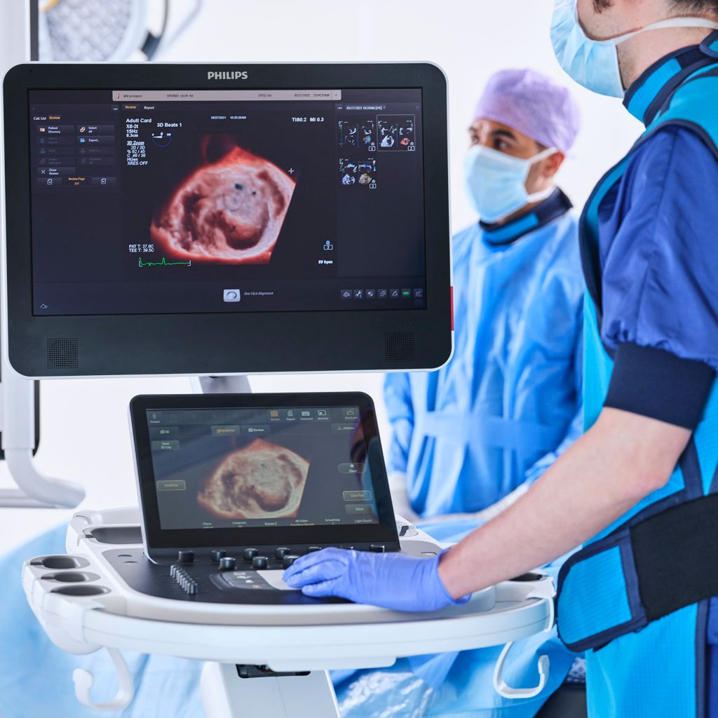 Echocardiography epiq image