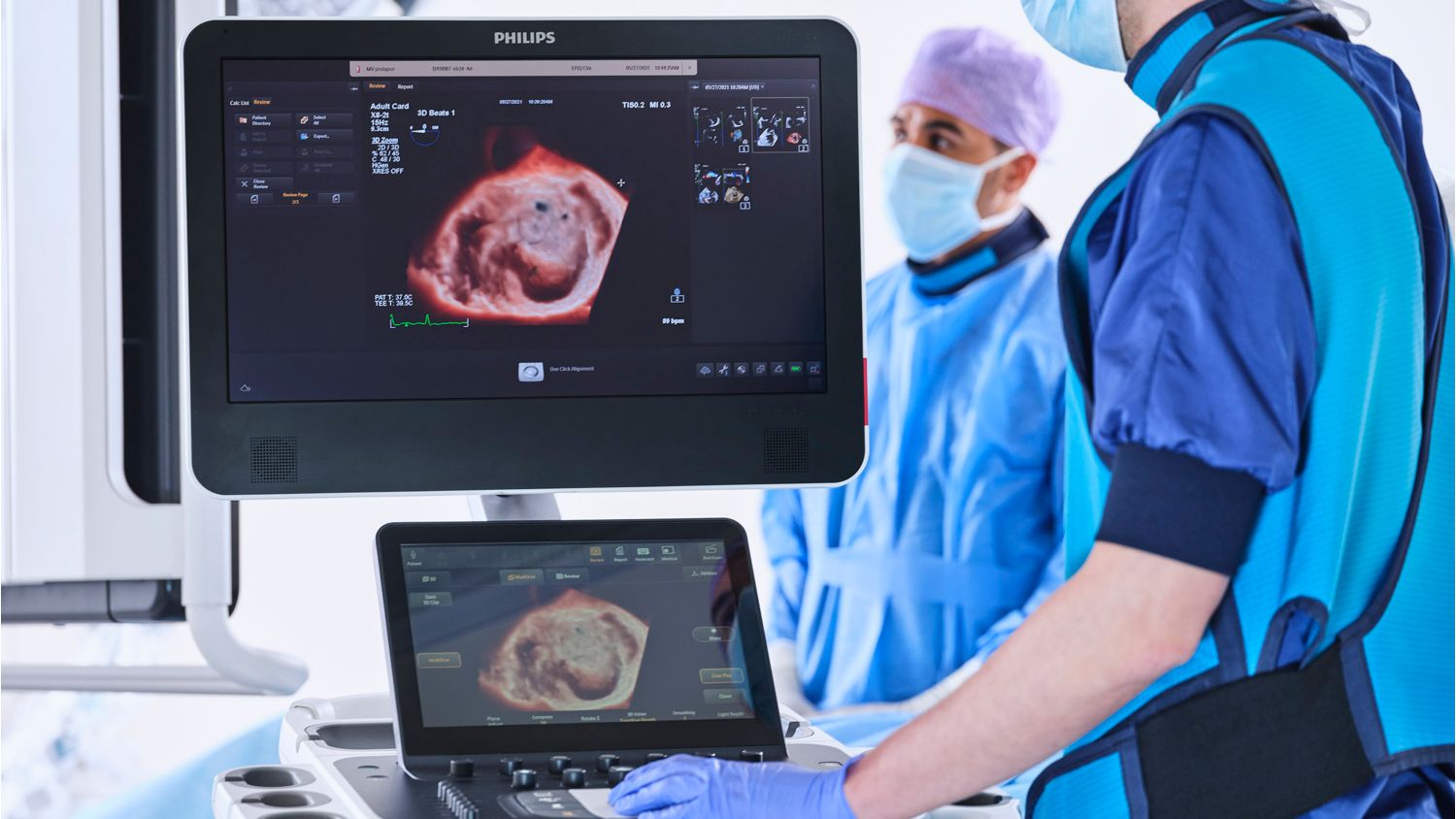 Clinical image - structural heart disease procedure