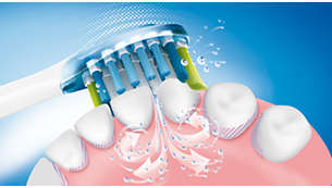 Patentert Sonicare-tannbørsteteknologi