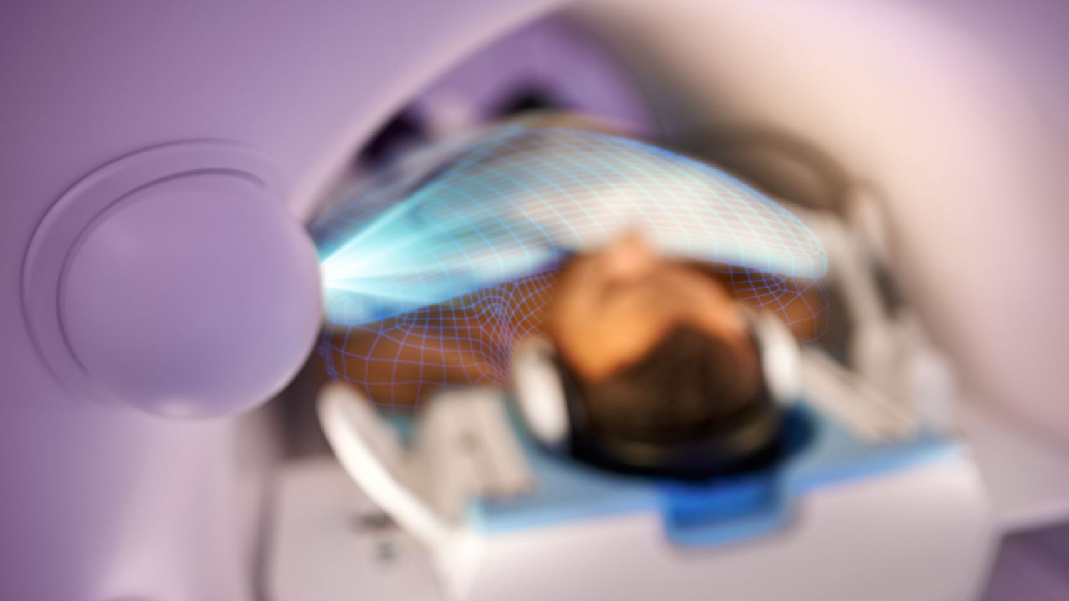 VitalEye touchless patient sensing provides breathing detection without a respiratory belt and without any operator interaction.