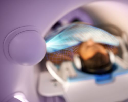 AI detecteert ademhaling van de patiënt