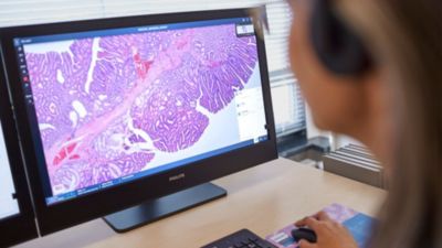 Clinician reviewing digital pathology image on a Philips diagnostic monitor
