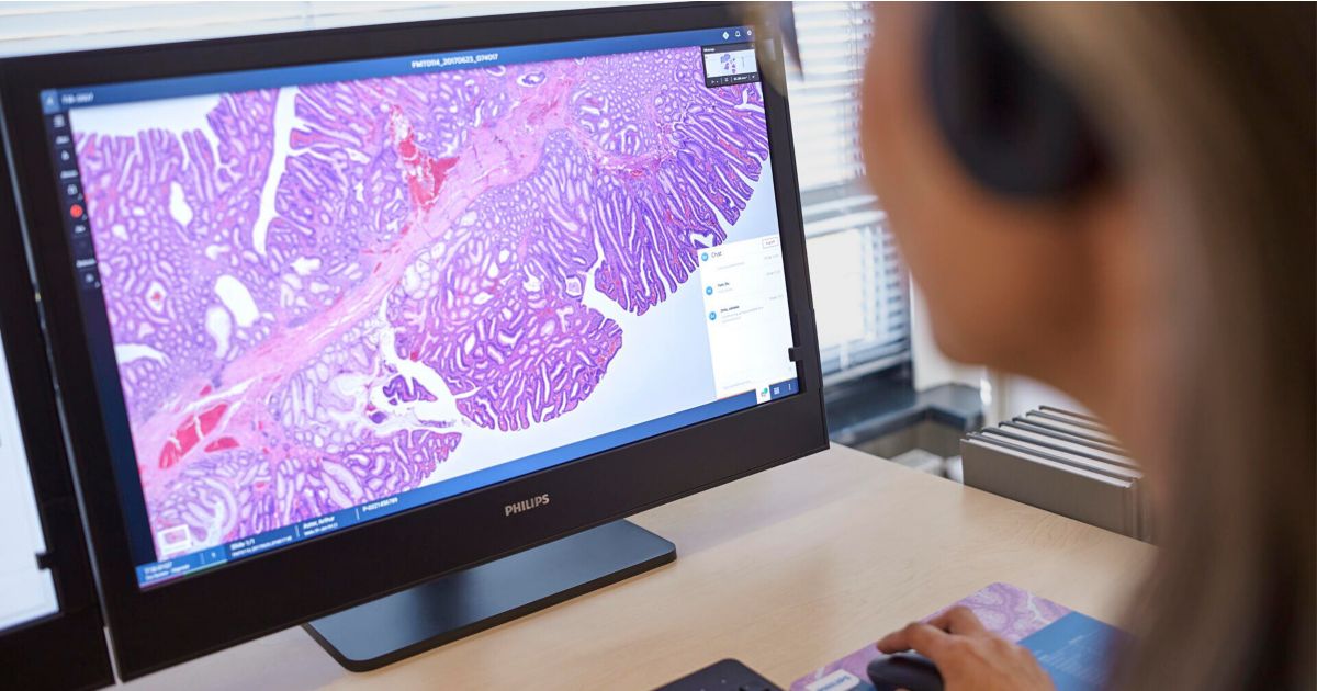Philips and Histolab Launch Strategic Partnership to Enhance Digital ...