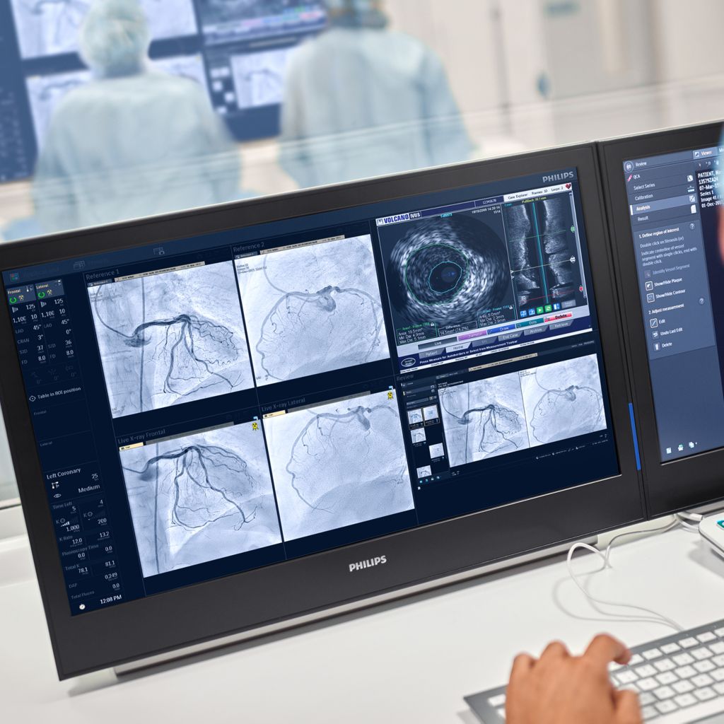 IGT Azurion ClarityIQ screen