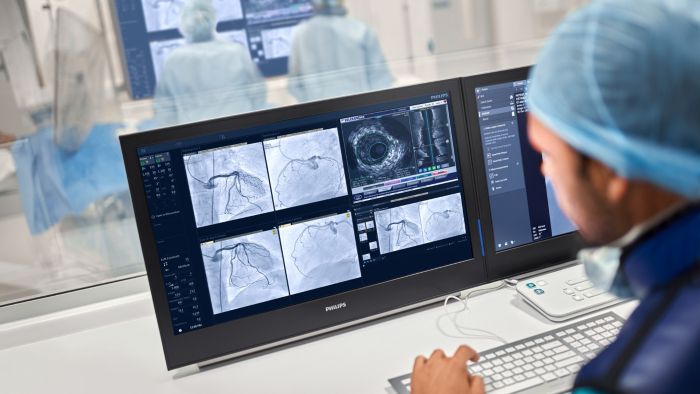 Решения Philips для достижения показателей Федерального проекта «Борьба с сердечно-сосудистыми заболеваниями»