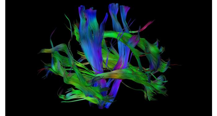 NeuroScience MR Clinical application | Philips