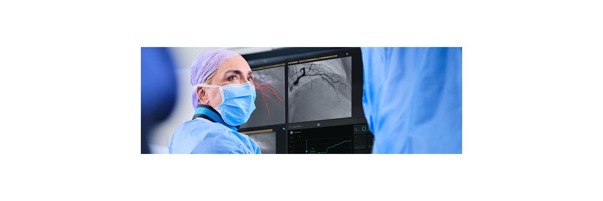smartIQ coronary imaging cathlab