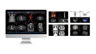 モニター上のVue PACS医用画像システム