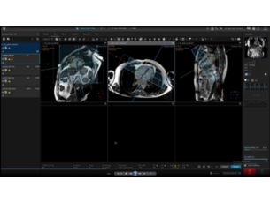 Easy Scan Plan - cardiac MR Clinical applications