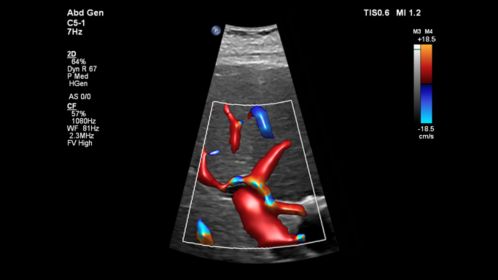 C5-1 Liver Perfusion with Flow Viewer