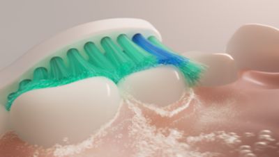 Proven Sonicare technology