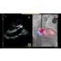 EchoNavigator R4: Heart model with transseptal area visualization thumbnail