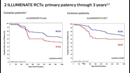 Top-tier patency and safety with the lowest effective drug dose in all SFA patients – common to complex*†