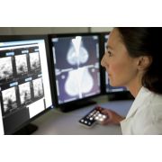 IntelliSpace Radiology with Advanced Mammography Diagnostic mammography