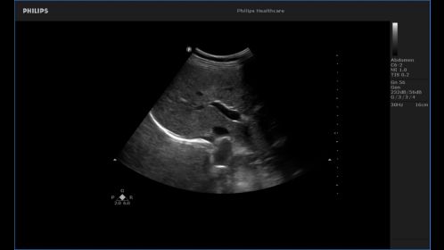 Liver image