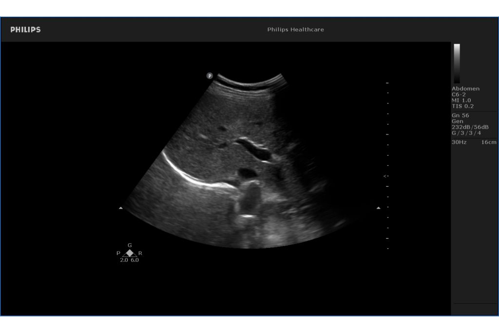 Liver image
