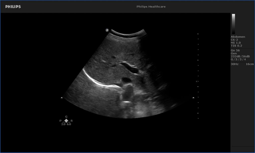 Liver image