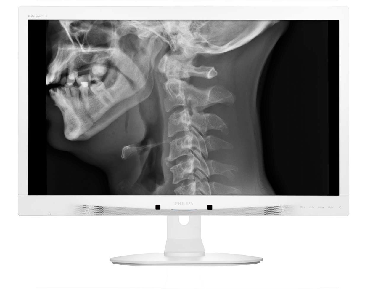 Écran pour diagnostics cliniques