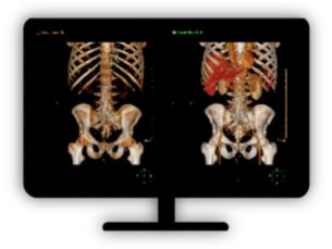 CT Spectral Viewer​ Optimized for analysis of spectral data sets from the Spectral CT Scanner