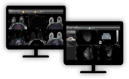 DynaCAD Breast Advanced post-processing imaging system for Breast MRI analysis