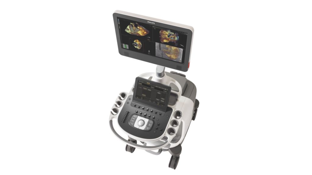 Cardiac Ultrasound machine