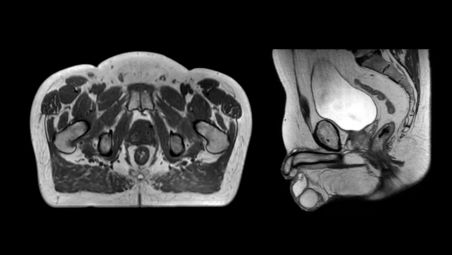 Fast, consistent imaging protocol