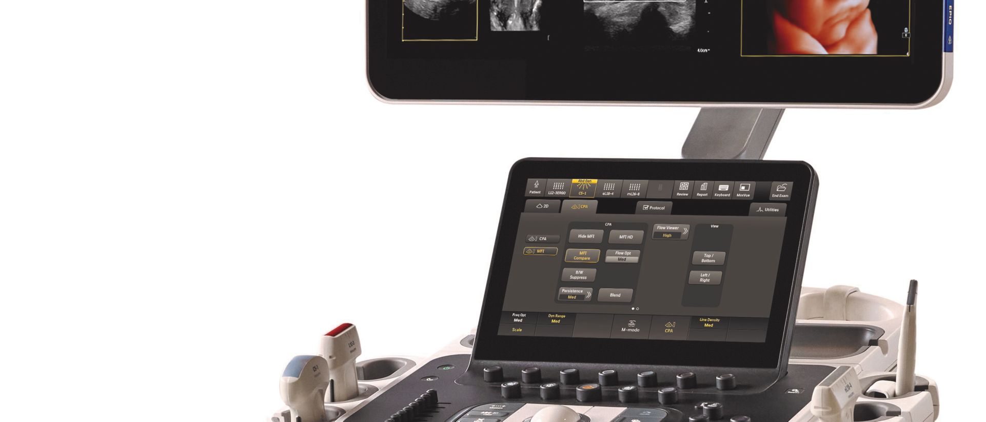Ultrasound Epiq Elite