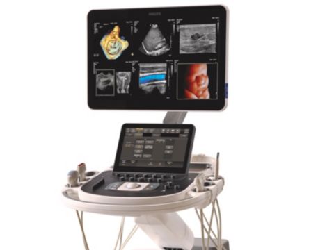 Philips EPIQ Elite ultrasound system