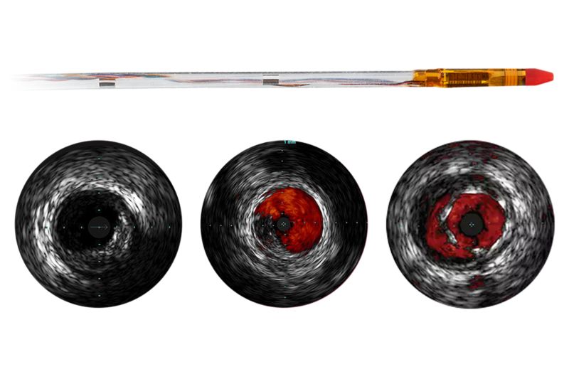 Eagle Eye Platinum Short Tip — Digital IVUS Catheter