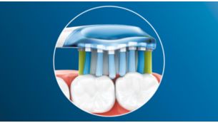 La tête de brosse flexible s'adapte aux contours de vos gencives