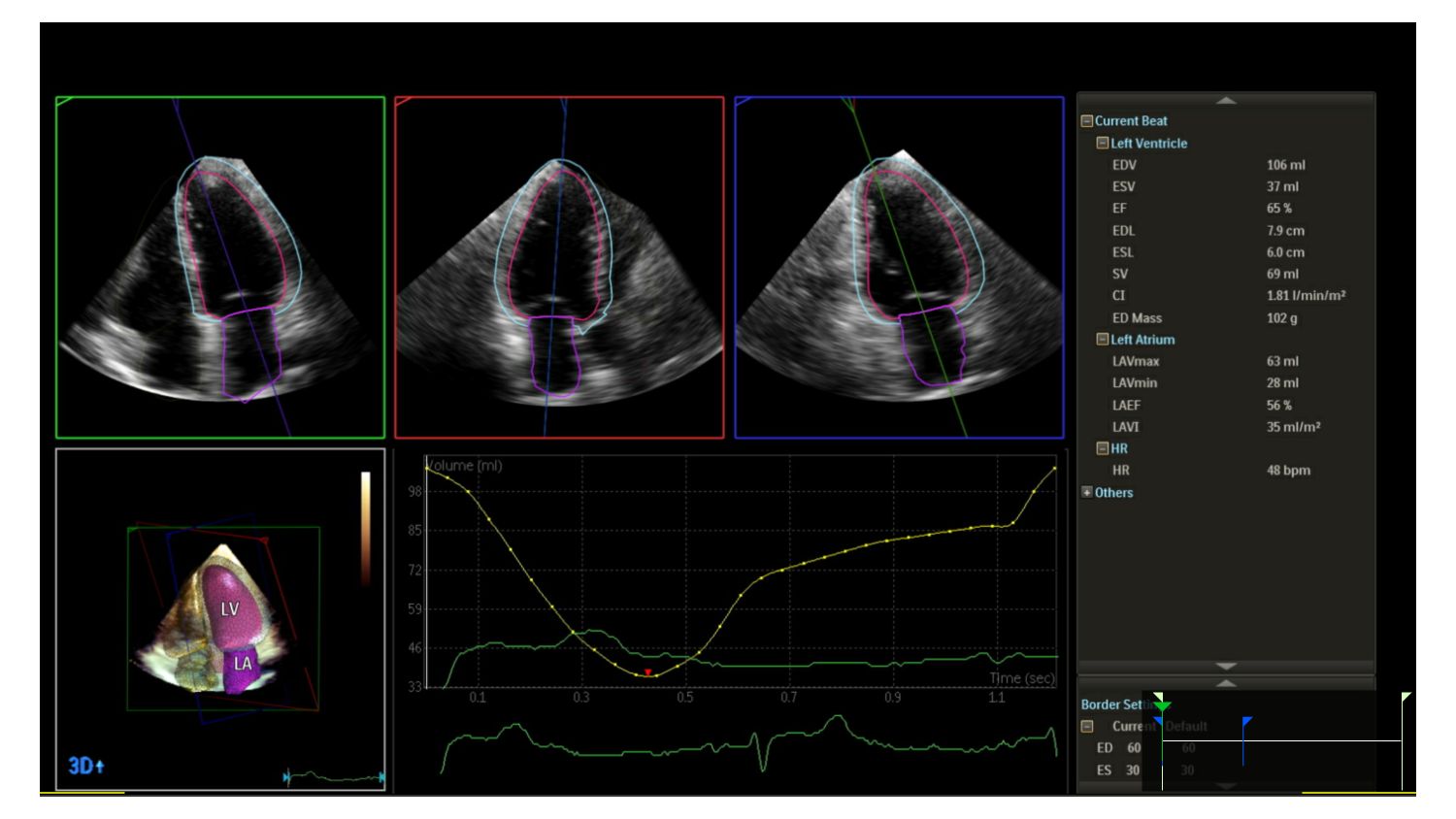 Affiniti CVx Clinical Image