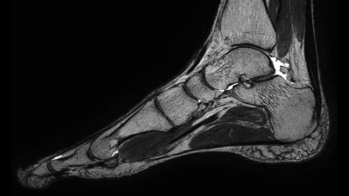 Sagittal 3D VIEW - T2w TSE
