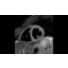Cardiac MS/QF MR clinical application thumbnail