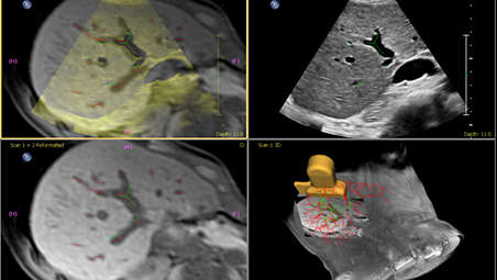 Anatomically Intelligent ultrasound - machine intelligence for faster more reproducible analysis