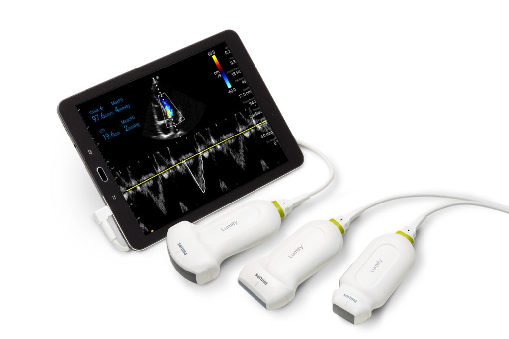 Philips Lumify ultrasound for Android shown with three transducers 