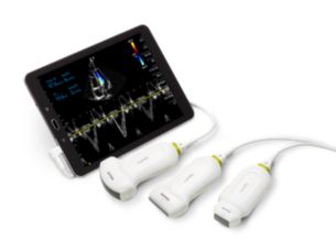 Lumify Exceptional portable ultrasound system for Android