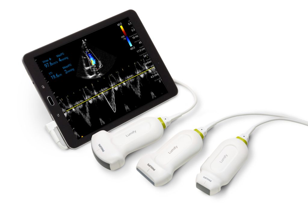 Lumify for Android Exceptional portable ultrasound system for Android