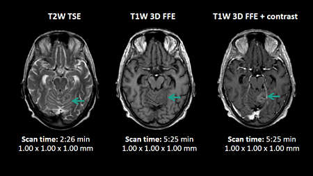 T1W and T2W contrasts - brain