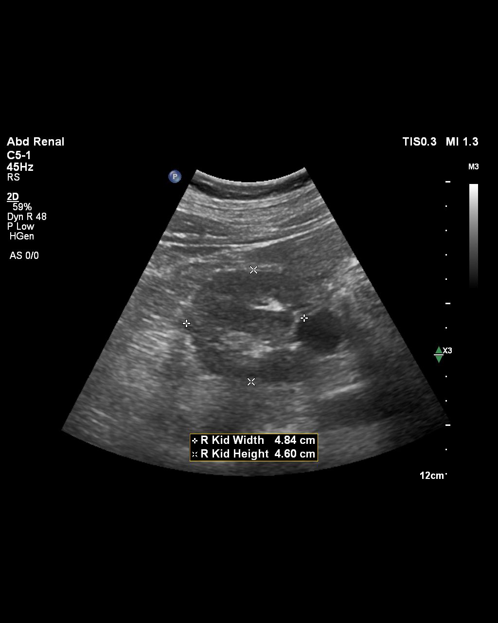 clinical image of abdominal ultrasound scan