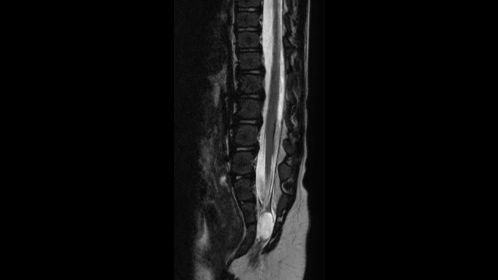 Sagittal T2w (5kg)