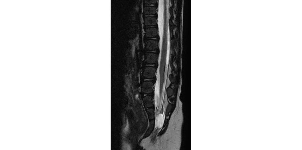 Sagittal T2w (5kg)