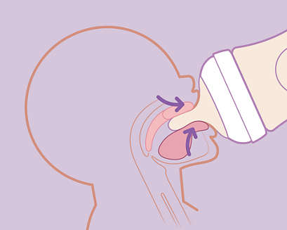 Sicherer Halt des Säuglings im Rhythmus Saugen-Schlucken-Atmen (SSA)