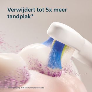 Sonicare 3100 Oplaadbare tandenborstel