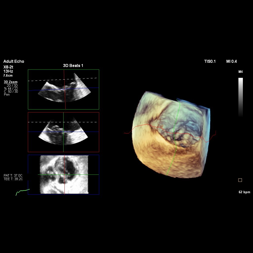 Next-generation TEE imaging