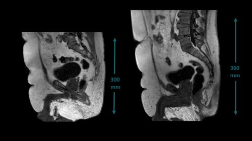 Large field of view imaging