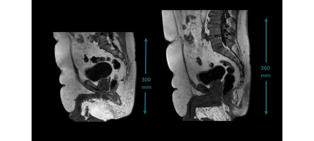 Large field of view imaging