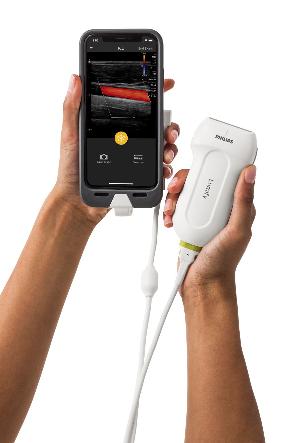 Lumify transducer and accessories connected to iPhone