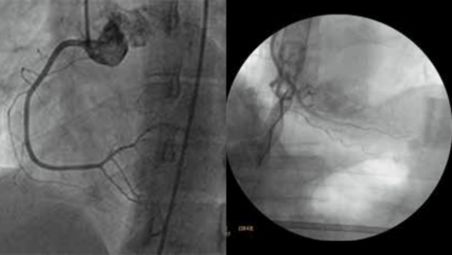 Exceptional contrast and clarity 
for cardiac exams